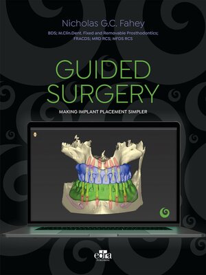 cover image of Guided surgery